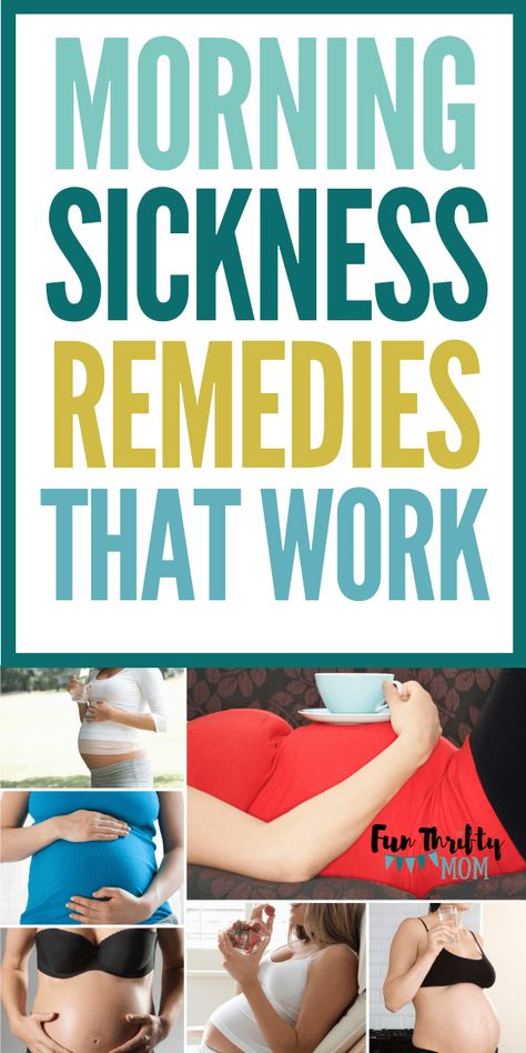 Early pregnancy morning sickness remedies that work! These natural remedies for pregnancy will having you feeling better in no time! Natural Morning Sickness Remedies, Morning Sickness Symptoms, Pregnancy Morning Sickness, Sickness Remedies, Morning Sickness Remedies, Nausea Pregnancy, Sick Remedies, Pregnancy Must Haves, Early Pregnancy