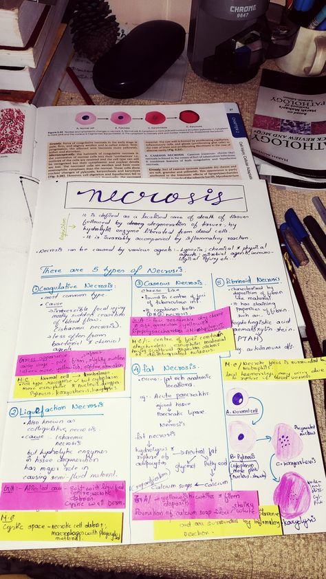 Pathology notes Necrosis Pathology Notes, Cell Injury Pathology Notes, Necrosis Pathology, Pathology Wallpaper, Pathology Notes Medical Students, Pharmacology Nursing Study Notes, Pathology Aesthetic, Pathology Notes, Medsurg Nursing