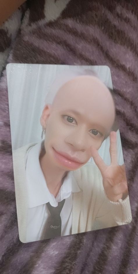 Bald Lee Know, Bald Kpop Idols, Bald Skz, Bald Idols, Bald Yeonjun, Bald Person, Bald Boy, Skz Funny, Skz Memes