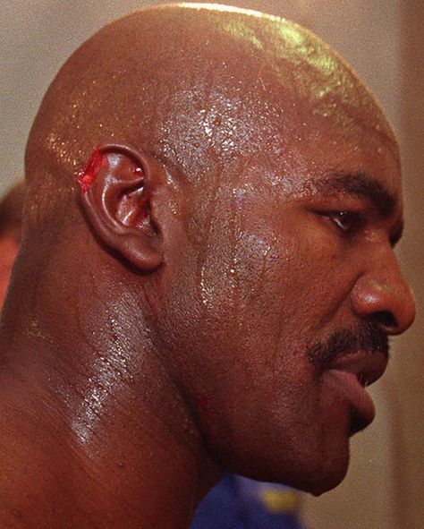 A close-up of Evander Holyfield’s ear, which was famously... Cheap Poster Prints, Evander Holyfield, Boxing History, Cheap Posters, Mouth Guard, Mike Tyson, Frame Shop, Professional Photo, Martial Arts