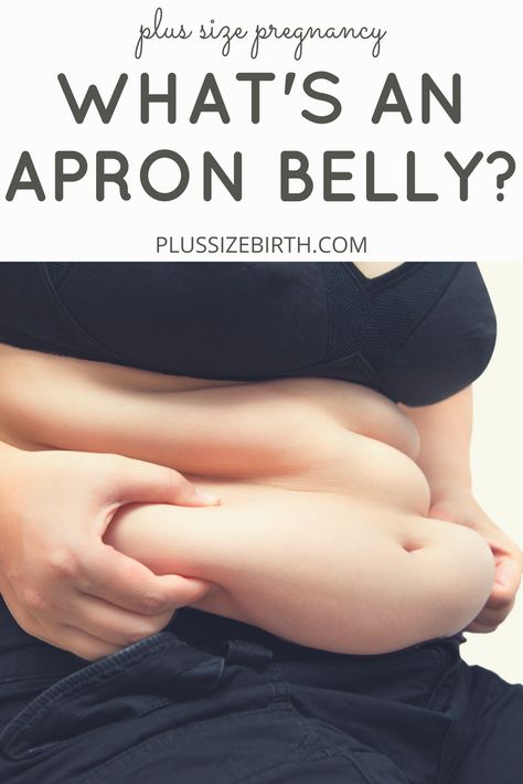 Apron Belly | What's an apron belly | Practical tips and solutions for an apron belly | Mothers Apron Mothers Apron Belly Exercises, Belly Apron Before And After, Belly Apron Fat How To Get Rid, Get Rid Of Apron Belly, How To Get Rid Of Apron Belly, Apron Belly Before And After, Apron Belly How To Get Rid Of, Apron Belly, Apron Belly Workout