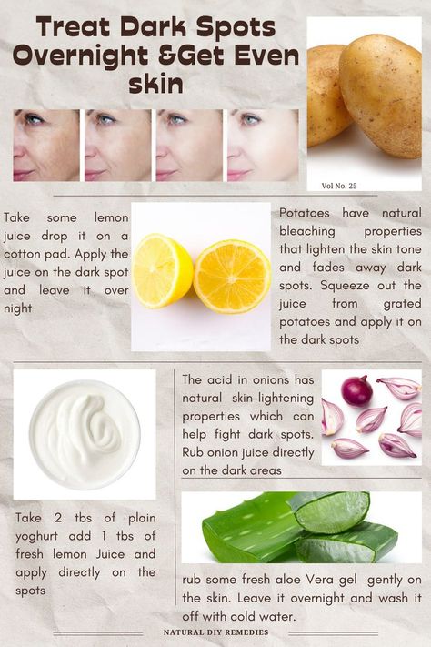 How To Remove Dark Spots On Face, Dark Spot Remover For Face, Natural Skin Lightening, Onion Juice, Ayurvedic Healing, Dark Spots On Face, Spots On Face, Remove Dark Spots, Get Even