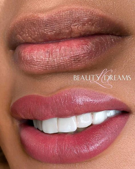 Lip Blushing on Dark Lips: Can Lip Blush Neutralize Dark Lips? Lipblush Before And After, Lip Blushing Before And After, Lipstick For Dark Lips, Lip Blushing Tattoo Before And After, Lip Blushing Tattoo Colors, Lip Blushing Tattoo, Lip Hyperpigmentation, Cosmetic Lip Tattoo, Blush For Dark Skin