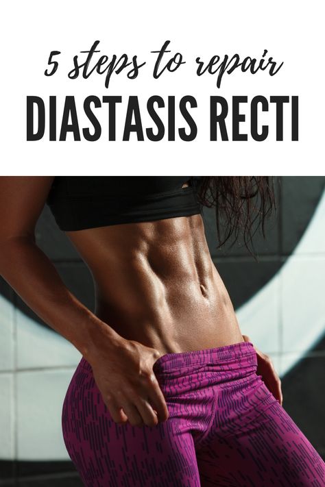 How to fix diastasis recti (divarication) or stomach muscle separation in 5 easy steps; 1. Stomach vacuums. 2. Specific ab exercises for people with the condition (link below). 3. Planks. 4. Waist trainer. 5. Diet Click the link to see the full guide. Stomach Muscle Separation, Muscle Separation, Core Exercises For Beginners, Stomach Vacuum, Core Exercises For Women, Healing Diastasis Recti, Beginner Pilates, Diastasis Recti Exercises, Beginner Workouts