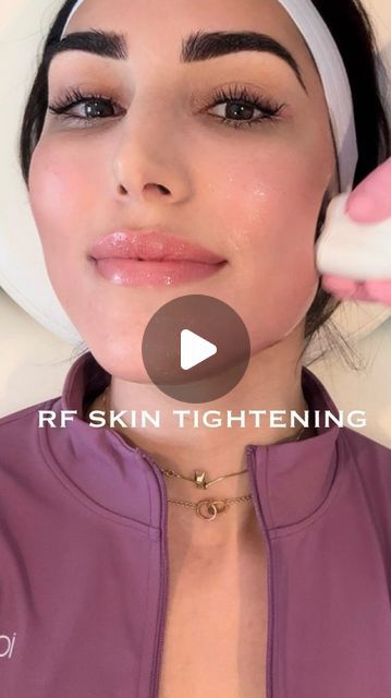 Sheila Shahram on Instagram: "Lately I’ve been obsessed with radio frequency skin tightening to help prevent jowls, sculpt my cheekbones, and keep this jawline snatched 👏🏽 

Thank you so much @nursefiona @nursefionaskin for keeping me looking and feeling 23 at 33 😋

🏷️ #facialtreatment #skintreatment #skintightening #rftreatment #antiaging #jawlinecontouring #facials #cheeklift #jowllift" Facial Before And After, Radio Frequency Facial, Skin Recipes, Cheek Lift, Radio Frequency Skin Tightening, Tighten Facial Skin, Facial Tips, Skin Tightening Face, Skin Food