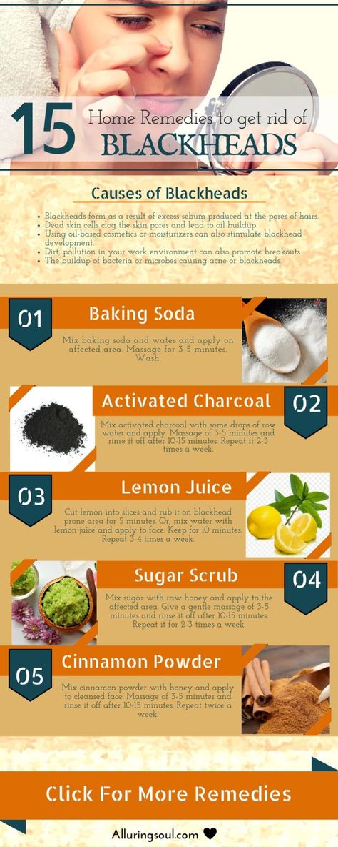 Home Remedies For Blackheads Homemade Peel Off Face Mask, Remedies For Blackheads, Make Skin Glow, Peel Off Face Mask, Face Mask For Blackheads, For Blackheads, Blackhead Remedies, Diy Masks, Mask Recipes