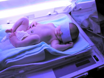 Jaundice In The Breastfed Baby Jaundice Newborn, Labor Doula, Baby Number 2, Newborn Baby Care, Birth Doula, Breastfed Baby, Baby Belly, Pediatric Nursing, Pregnancy Birth