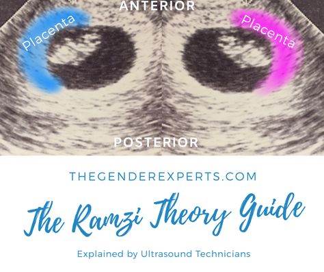 Early Gender Prediction, Ramzi Theory, Anterior Placenta, Ultrasound Gender, Nub Theory, Gender Predictor, Unique Baby Shower Ideas, Baby Gender Prediction, Ultrasound Technician