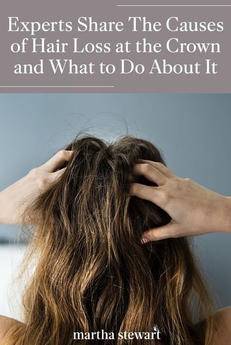 How To Help Itchy Scalp, Products For Itchy Scalp, Flaky Scalp Remedy, Psoriatic Scalp, Hair Thinning At Crown, Extremely Dry Scalp, Itchy Scalp Causes, Scaly Scalp, Flakey Scalp