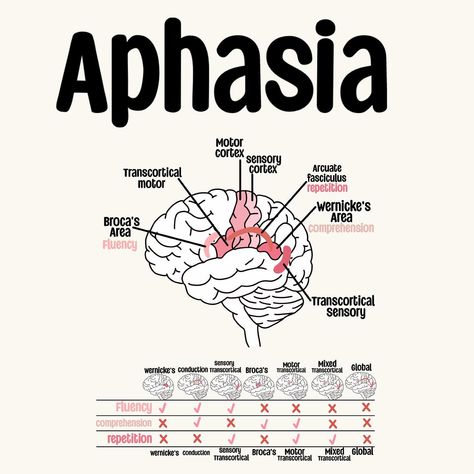 A look at Aphasia 🧠 Study Set Available on my TPT!🩷 . . . . . . . . . . #sIp #speechpathology #sIpgradstudent #sIpgradschool #gradstudent #Speechtherapy #sIpgradlife #speechlanguagepathology #speechlife #slptobe #bilingualslp #cuethespeech #aestheticanatomy #slpaesthetic #lifeisspeechie #fixasha #slpfinds #slpmusthaves #speechfinds #speechie #slpanatomy #anatomy Slp Praxis Study Guide, Speech Therapy Aesthetic, Speech Pathology Aesthetic, Slp Praxis, Slp Aesthetic, Speech Language Pathology Grad School, Linguistics Study, Praxis Study, Speech Therapy Tools