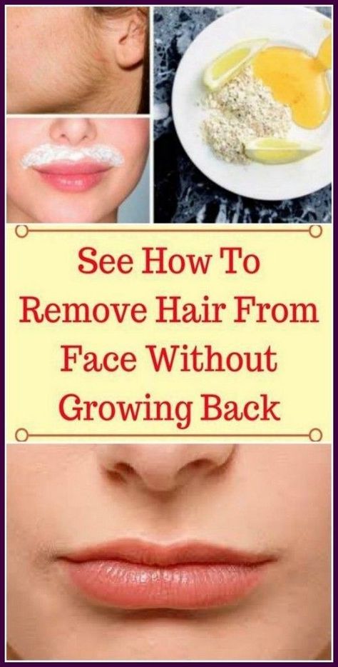 Remove Unwanted Facial Hair Permanently with This Recipe Permanent Hair Removal Cream, Remove Unwanted Facial Hair, Natural Mask, Underarm Hair Removal, Remove Hair, Unwanted Facial Hair, Facial Hair Removal, Hair Removal Permanent, Hair Removal Cream