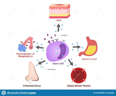 Mast Cell Activation, Mast Cell Activation Syndrome, Mast Cell, Chronic Migraines, White Illustration, Body Pain, The Natural, Immune System, Biology