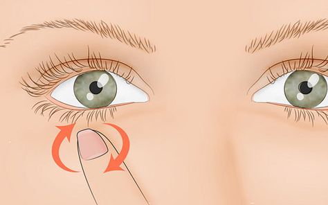 How to Stop Eye Twitching: 7 steps - wikiHow -- Just used this to stop my eye from twitching and it worked! Pinning for future use! Stop Eye Twitching, Dance Meaning, Eye Twitching, Muscle Spasms, Homemade Remedies, Dry Eyes, Eye Health, Health Info, Eye Care