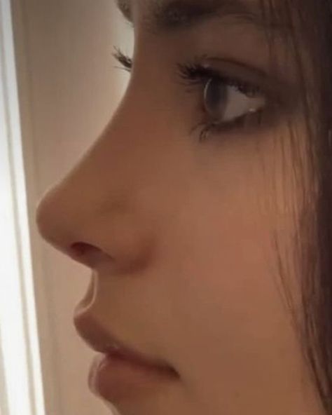 Upturned Nose, Rhinoplasty Nose Jobs, Job Inspiration, Straight Nose, Pretty Nose, Perfect Nose, Button Nose, Beauty Goals, Nose Job