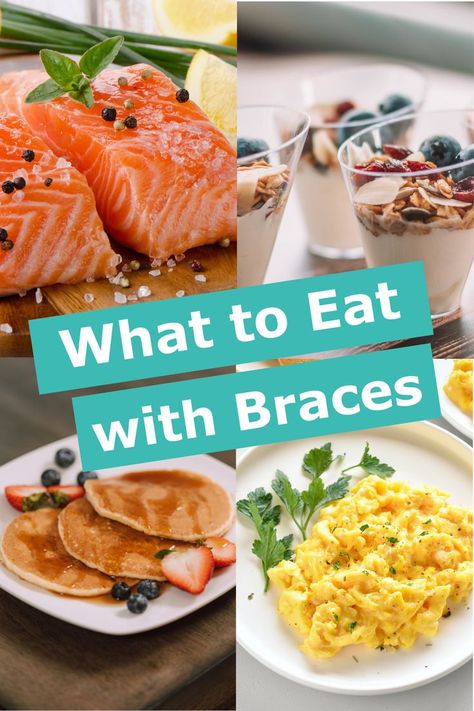 Things To Eat After Getting Braces, Dinner Ideas For Braces Soft Foods, Meals For New Braces, Foods To Eat With Braces Soft, Soft Foods After Braces Ideas, Braces Food Ideas Meals, Soft Food Braces Ideas, Good Food To Eat With Braces, Braces Food What To Eat With