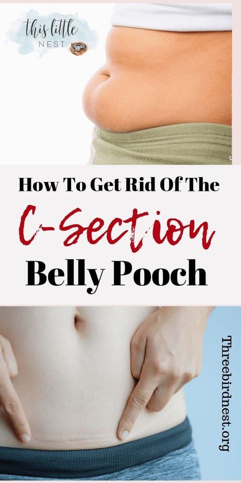 How To Eliminate Your "Mummy Tummy" After A C-Section | This Little Nest C Section Belly, C Section Workout, Tummy Pooch, Post Baby Workout, Mummy Tummy, Post Pregnancy Workout, Pregnancy Belly, Belly Pooch, Baby Workout