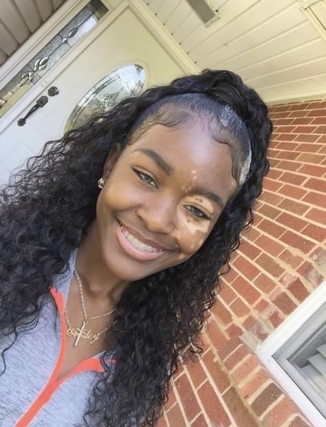 𝙋𝙞𝙣𝙩𝙚𝙧𝙚�𝙨𝙩@𝙪𝙙𝙭𝙣𝙩𝙢𝙖𝙩𝙩𝙚𝙧 Blonde Lace Wig, Brace Face, Ponytail Wig, Lace Frontal Wigs, Dark Skin Beauty, Hair Blonde, Hair Life, Hair Quality, Lace Wig