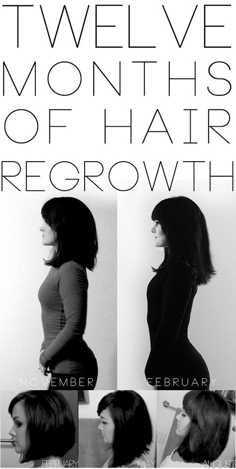 How to Grow Out Your Hair in One Year- great tips on shampoo, supplements and other products she used and tested. Makes me feel a little better about having to lop off some major inches... Regrow Hair, Healthy Hair Tips, Hair Remedies, Hair Growth Tips, Hair Regrowth, Hair Envy, Grow Out, Hair Today, Great Hair