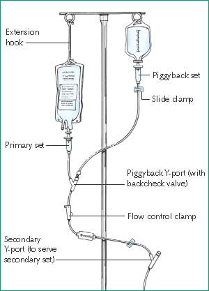 An image of a standard IV pump with primary and secondary tubing. In my design, using the original spike and flush bag tubing for feeds, the primary is the flush bag (as in the case of IVs), and the secondary is the feed (which is the medication in the case of IVs). Iv Therapy Nursing, Iv Bag Aesthetic, Iv Pumps Nursing, Nursing Student Organization, Biology College, Nursing School Life, Nursing Goals, Nursing School Prerequisites, Nursing Fun