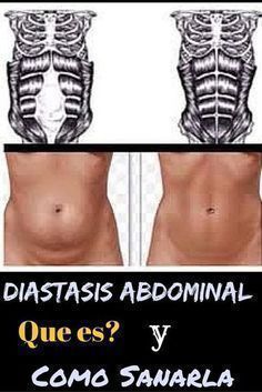 Diástase Abdominal, Chirstmas Decor, Mommy Workout, Diastasis Recti, Eyes Makeup, Belly Workout, Fitness Workout For Women, Burn Belly Fat, Body Health