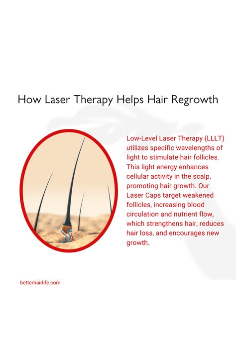 How does laser therapy help hair regrowth? 🌟   Low-Level Laser Therapy (LLLT) uses specific wavelengths of light to stimulate hair follicles, enhancing cellular activity in the scalp. Our Laser Caps target weakened follicles, increasing blood circulation and nutrient flow, which strengthens hair, reduces hair loss, and encourages new growth.   #HairGrowth #LaserCap #BetterHairLife #HairCare #HealthyHair #BeautyTech #DoctorApproved #HairRegrowth #LaserTherapy #BeautyScience Low Level Laser Therapy, Beauty Science, Stimulate Hair Follicles, Laser Therapy, Me Board, Hair Follicles, Light Energy, Hair Regrowth, Promotes Hair Growth