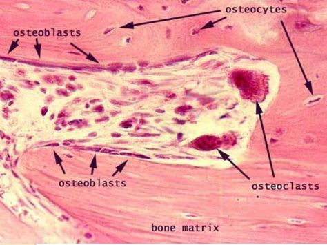 Bone Cells, Tissue Biology, Histology Slides, Oral Pathology, Anatomy Physiology, Degenerative Disease, Bone Diseases, Aging Population, Medical School Essentials