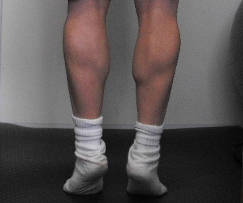 My calf muscles. Muscles Exercises, Thick Calves, Calf Exercises, Best Resistance Bands, Big Calves, Gym Routine, Lifting Weights, Thigh Exercises, Calf Muscles