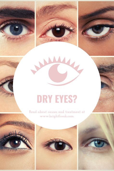 No matter the cause of the problem, read on to see remedies for dry eyes. We guarantee, there won’t be a dry eye in the place when we’re done. Dry Eye Remedies, Eye Twitching, Nail Problems, Dry Eyes Relief, Dry Eye, Eye Sight Improvement, Vision Eye, Light Sensitivity, Vision Problems