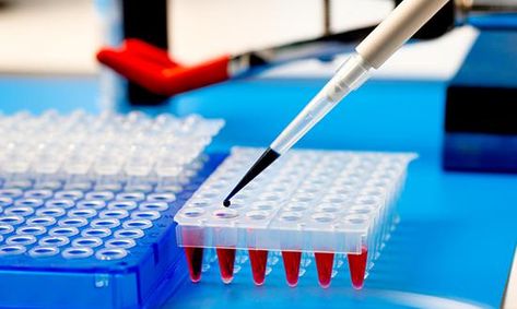 Enzyme Linked Immunosorbent Assay (ELISA) is one of the promising techniques used for the detection and quantification of biological analytes such as peptides, proteins, antibodies, and hormones. Be Valued, Senior Health, Genetic Testing, Medical Conditions, How To Stay Healthy, Health And Wellness, Health Care, Lab, Marketing