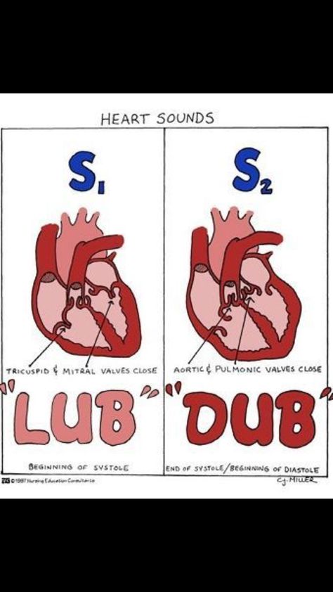 Heart sounds Cardiac Assessment, Nursing Leadership, Nursing Assessment, Heart Sounds, Heart Valves, Basic Anatomy And Physiology, Nursing Mnemonics, Surgical Nursing, Medical Surgical Nursing