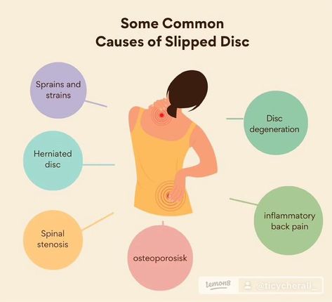 Living with chronic pain is something I don’t wish on anyone. But… Here are a few things you can do to help aid the pain of sciatica and other spinal pain. #PLEASE check with your #Doctor before trying any of these stretches…  #sciaticaawareness #sciaticnerve #sciatica #explorepage #fyp #instagram #facebook #tiktok #sciaticarelief #stretchprincess #sciaticasolutions #sciaticapainrelief #stretchceiling Slip Disc, Living With Chronic Pain, Healthy Spine, Sciatica Pain Relief, Sciatica Relief, Health Talk, Sciatic Nerve, Poor Posture, Posture Correction