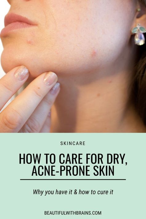 Skin Care For Acne And Dry Skin, Dry And Acne Prone Skin, Dry Skin Acne Skincare, Dry Sensitive Acne Prone Skin Skincare, Skincare Routine For Dry Sensitive Acne Prone Skin, Sensitive Acne Prone Skin Care Routine, Skin Care For Dry Acne Prone Skin, Best Makeup For Acne Prone Skin, Dry Acne Prone Skin Routine