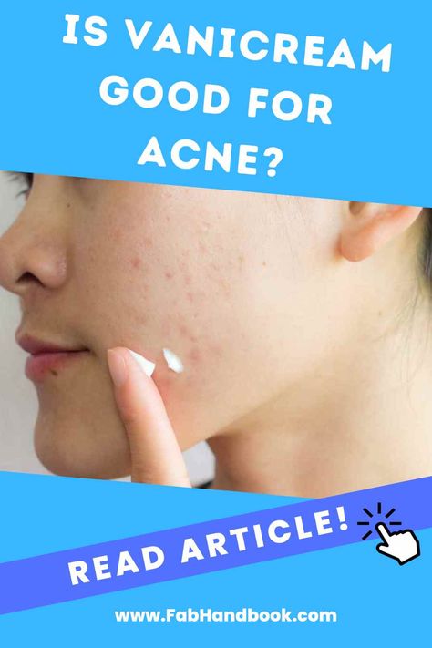 Learn about Vanicream's benefits and drawbacks for acne-prone skin with our expert-backed article, tips for achieving a clear complexion. Clear Complexion, Acne Prone Skin, Oily Skin, Benefits, Acne, Skin