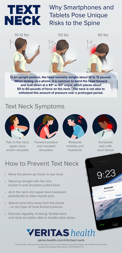 Text Neck Symptoms and Diagnosis Forward Head Posture Exercises, Text Neck, Tech Neck, Forward Head Posture, Spine Health, Leg Pain, Neck Pain, Signs