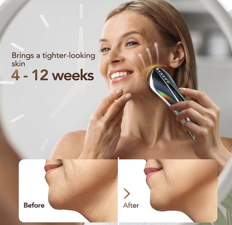 skin tightening, best gift for your partner, click on the image and go to the link, take care my friend Rf Skin Tightening, Skin Tightening Machine, Radio Frequency Skin Tightening, Led Therapy, Beauty Devices, Sagging Skin, Radio Frequency, Wrinkle Remover, Reduce Wrinkles