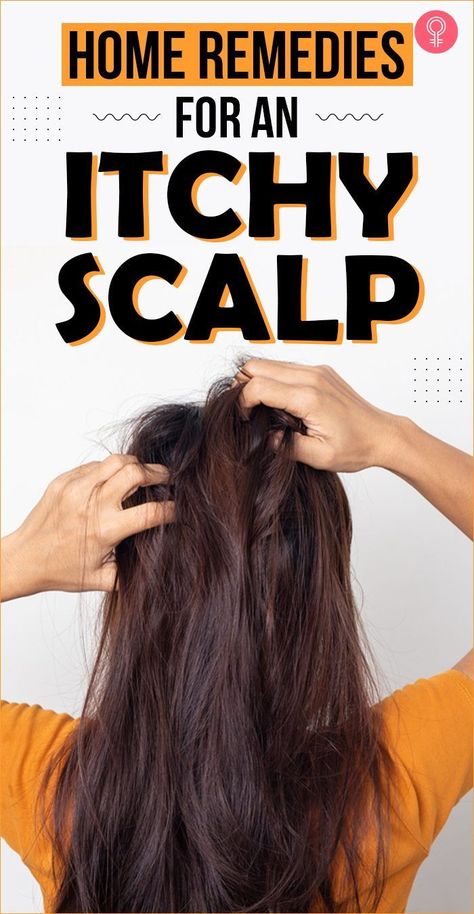 Home Remedies For An Itchy Scalp: there are plenty of home remedies that help treat itchy scalp. They help improve the health of your scalp, and consequently, your hair. In this article, we will discuss 14 easy and effective ways to reduce the itching of your scalp naturally at home. Keep scrolling to find them out. #remedies #homeremedies #itchyscalp #scalpcare Soothe Itchy Scalp, Products For Itchy Scalp, Dry Itchy Flaky Scalp Remedy, Natural Remedies For Itchy Scalp, Scalp Care Itchy, Head Itching Remedies, Scalp Irritation Remedies, How To Treat Itchy Scalp, Itching Scalp Remedies Hair