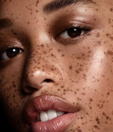 Dark Freckles, Black Girls With Freckles, Freckles Makeup, Beautiful Freckles, Beauty Advertising, Freckles Girl, Oc Inspiration, Character Pictures, Beauty Photoshoot