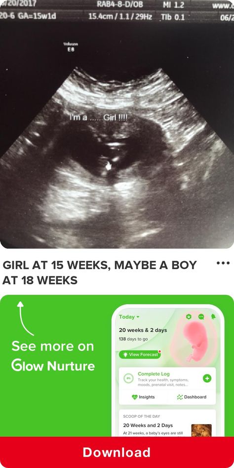 15 Week Ultrasound, Pregnant Ultrasound, 15 Weeks Pregnant, 3d Ultrasound, Pregnancy Ultrasound, Prenatal Health, Pictures Funny, Baby Bump, Prenatal