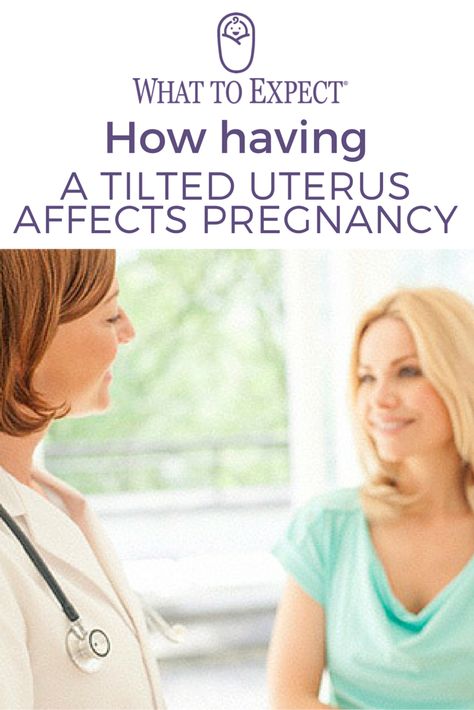 If you're among the one in five women with a tilted (a.k.a., retroverted) uterus, more often than not it's nothing to worry about if you're trying to get pregnant or have already conceived. Here, the most common questions and answers. #tilteduterus #whattoexpect | whattoexpect.com Tilted Uterus, Retroverted Uterus, Tips To Get Pregnant, How To Conceive Twins, How To Conceive, Fertility Boost, Trying To Get Pregnant, Twin Pregnancy, Get Pregnant