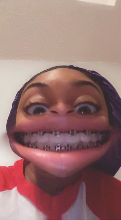 black braces Black Braces No Power Chain, Black Power Chain Braces, Black Braces On Black People, Black Braces Teeth, Braces Selfie, Braces Black Women, Pretty Black Women With Braces, Braces On Black Girls, Pretty Braces