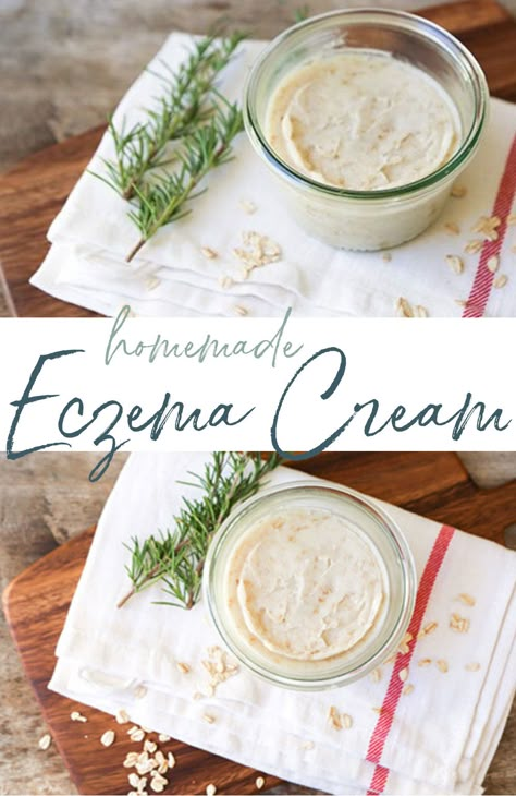 Homemade Eczema Cream Excema Diy Cream, Diy Excema Cream Recipes, Homemade Body Spray, Oil Therapy, Salve Recipes, Homemade Moisturizer, Skin Diet, Diy Cream, Rachel Hollis