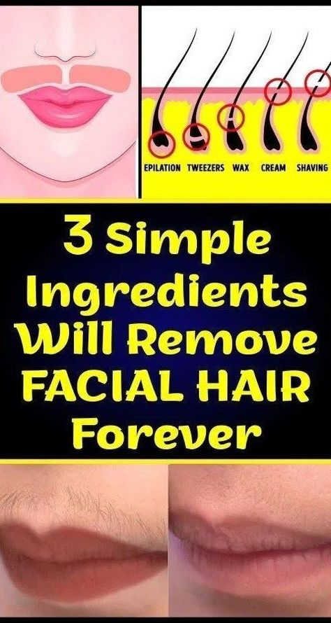 Best Facial Hair Removal, Unwanted Hair Permanently, Unwanted Facial Hair, Beauty Tips For Face, Facial Hair Removal, Hair Removal Permanent, Hair Removal Cream, Unwanted Hair Removal, Unwanted Hair