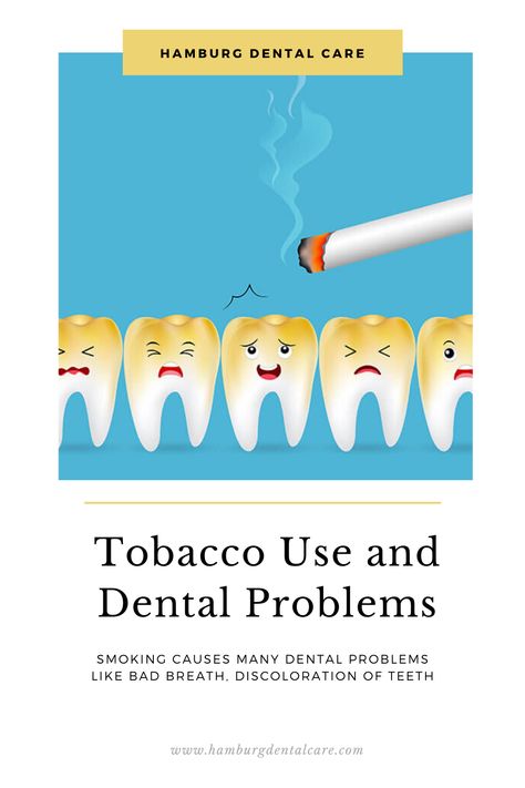 Smoking causes oral issues, like bad breath, discoloration of teeth and other long-term dental problems, read full blog to know more   #DentalTips #DentalHealth #Smoking #Tobacco #DentalProblems Dental Tips, Dental Decay, Strong Teeth, Teeth Health, Stronger Teeth, Dental Problems, Teeth Care, Tooth Decay, Dental Health