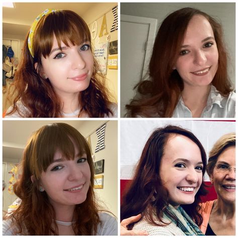 Recently bought some fake bangs on amazon to hide my big forehead. Opinions? Bangs or no bangs? #hair #hairstyle #hairstyles #beauty Big Forehead Bangs Before And After, Bangs To Hide Big Forehead, Hairstyles To Hide Forehead, Hide Big Forehead, Bangs For Big Forehead, Before And After Bangs, Bangs Vs No Bangs, Big Forehead Hairstyles, Bangs Or No Bangs