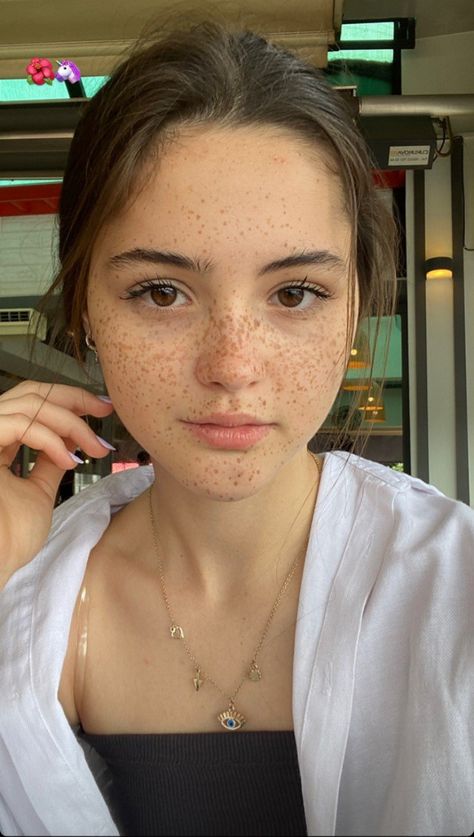 Face Freckles, Girl With Freckles, Glowing Skin Overnight, Acne Beauty, Cute Freckles, Women With Freckles, Beautiful Freckles, Freckles Girl, Freckle Face