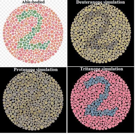 How to Adjust Your Designs to Minimize the Impact of Visual Stress and Color Blindness? Color Vision Deficiency, Colour Blind, X Chromosome, Optic Nerve, Genetic Diseases, Acai Bowls, Color Vision, Visual System, Types Of Colours