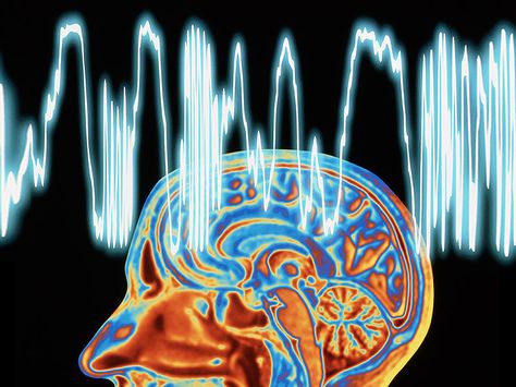 Abdominal Migraine, Mri Brain, Spinal Fluid, Migraine Headache, Cerebrospinal Fluid, Brain Scan, Diagnostic Imaging, Mri Scan, Magnetic Resonance Imaging