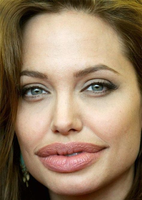 Big Mouth Celebrities - Gallery Before And After Photoshop, Angelina Jolie Photos, Celebrities Before And After, Celebrity Stars, Big Mouth, Jolie Photo, Angelina Jolie, Model Photos, Plastic Surgery