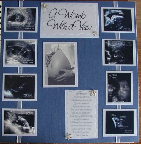 Ultrasound Pictures Scrapbook, First Trimester Scrapbook Page, Sonogram Scrapbook Page Ideas, Ultrasound Scrapbook Ideas, Maternity Scrapbook Ideas, Scrapbook Display Ideas, Baby Scrapbook Pages Layouts, Sonogram Picture Ideas Display, Scrapbook Ideas For Baby Boy