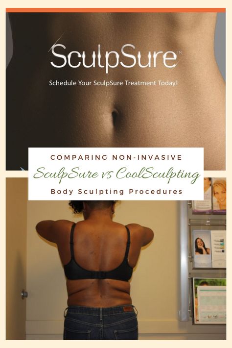 Air Sculpting Before And After, Cool Sculpting Before And After, Freezing Fat Cells, Fat Freezing, Cool Sculpting, Fat Reduction, Fat Removal, Love Handles, Best Blogs